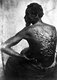USA: Injuries inflicted upon a Louisiana plantation slave by a vicious overseer, St Landry Parish, Louisiana, 1863