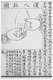 China: Pediatric 'tuina' hand massage diagram, Chinese woodcut, mid-Qing Dynasty (1644 - 1912), reproduced in Youke San Zhong ('Three volumes of Paediatrics'), c. 1940