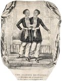 Chang and Eng Bunker (May 11, 1811 – January 17, 1874) were Thai-American conjoined twin brothers whose condition and birthplace became the basis for the term 'Siamese twins'.<br/><br/>

The Bunker brothers were born on May 11, 1811, in the province of Samut Songkram, near Bangkok, in the Kingdom of Siam (today's Thailand). Their fisherman father was a Chinese Thai, while their mother was a Chinese Malaysian. Because of their Chinese heritage, they were known locally as the 'Chinese Twins'. The brothers were joined at the sternum by a small piece of cartilage, and though their livers were fused, they were independently complete.<br/><br/>

In 1829, Robert Hunter, a Scottish merchant who lived in Bangkok, saw the twins swimming and realized their potential. He paid their parents to permit him to exhibit their sons as a curiosity on a world tour. When their contract with Hunter was over, Chang and Eng went into business for themselves. In 1839, while visiting Wilkesboro, North Carolina, the brothers were attracted to the area and purchased a 110-acre (0.45 km2) farm in nearby Traphill.<br/><br/>

Determined to live as normal a life they could, Chang and Eng settled on their small plantation and bought slaves to do the work they could not do themselves. Using their adopted name 'Bunker', they married local women on April 13, 1843. Chang wed Adelaide Yates, while Eng married her sister, Sarah Anne. Chang and Adelaide would become the parents of eleven children. Eng and Sarah had ten. The twins also became naturalized American citizens.<br/><br/>

On January 17, 1874, Chang died while the brothers were asleep. Eng awoke to find his brother dead and cried, 'Then I am going'. A doctor was summoned to perform an emergency separation, but he was too late. Eng died approximately three hours later.